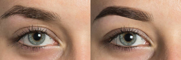 istockphoto 882317806 612x612